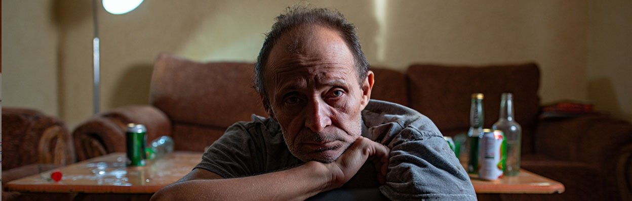 Мужчина с отеками на лице